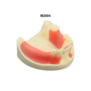 Практика зубной имплантации Модель зубов Typodont Съемная Десна Нижней Челюсти M2004 Стоматологическая Модель
