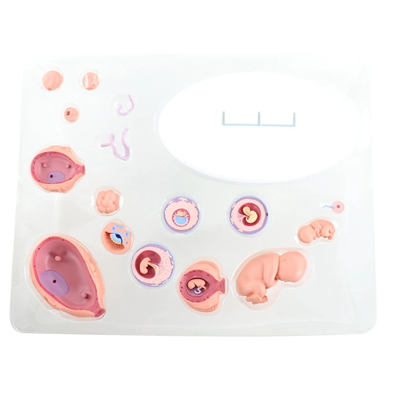 4D Анатомическая Модель Развития Человеческого Эмбриона, Обучающая Органу Роста Плода Alpinia Assembled Toys